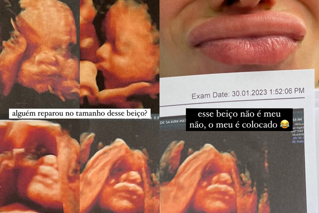 Petra Mattar mostra rosto do filho em ultrassom