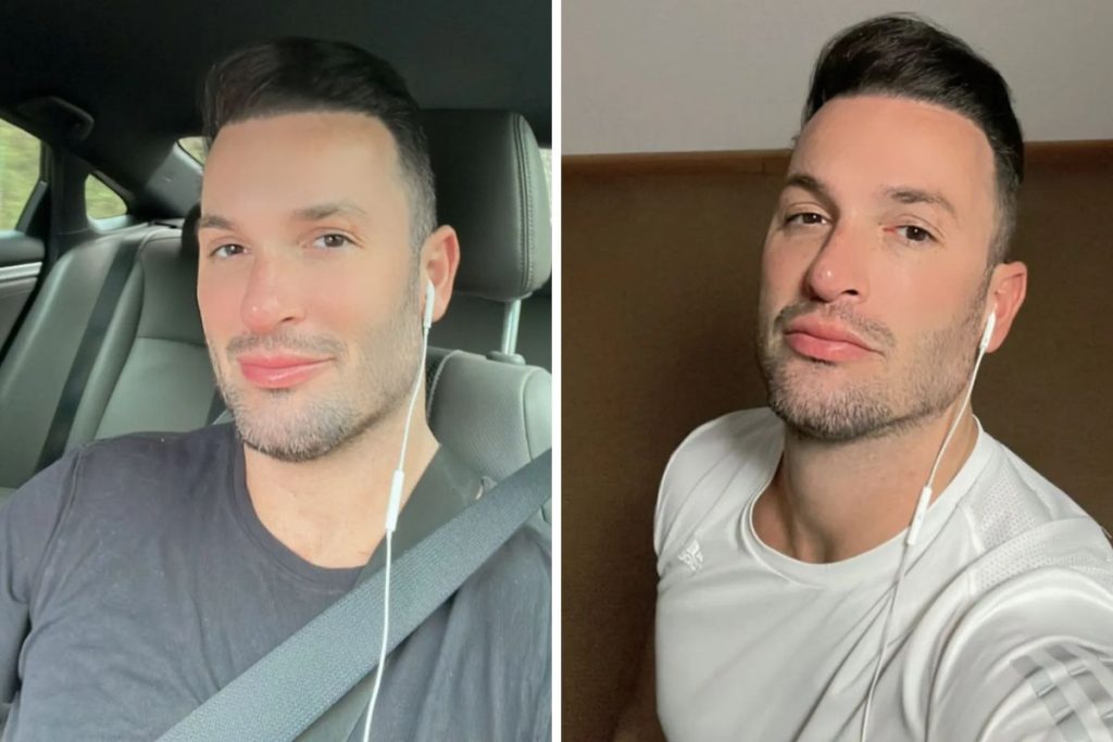 diego hypolito após cirurgias plásticas