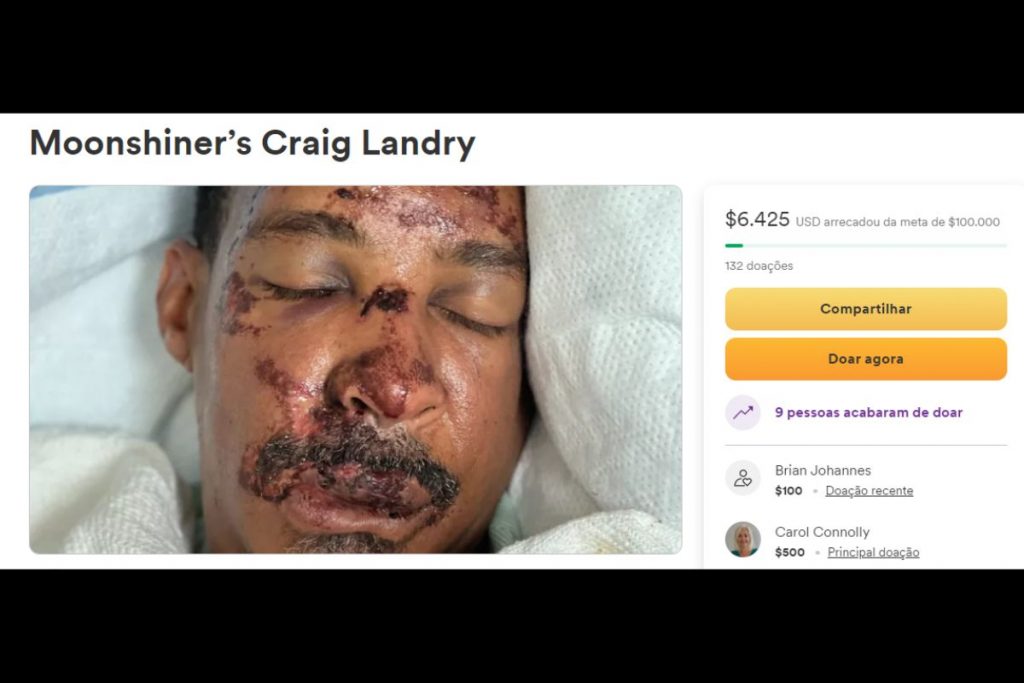 Craig Landry precisará fazer novas cirurgias na face