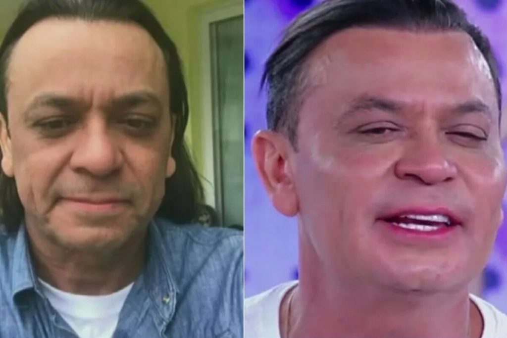 Frank Aguiar antes e depois 