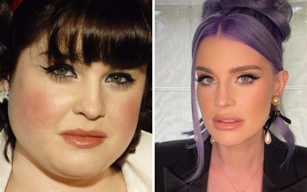 Kelly Osbourne antes e depois da cirurgia bariátrica