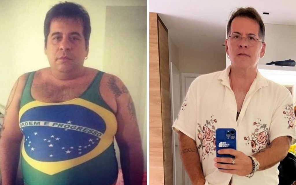 Leandro Hassum antes e depois da cirurgia bariátrica