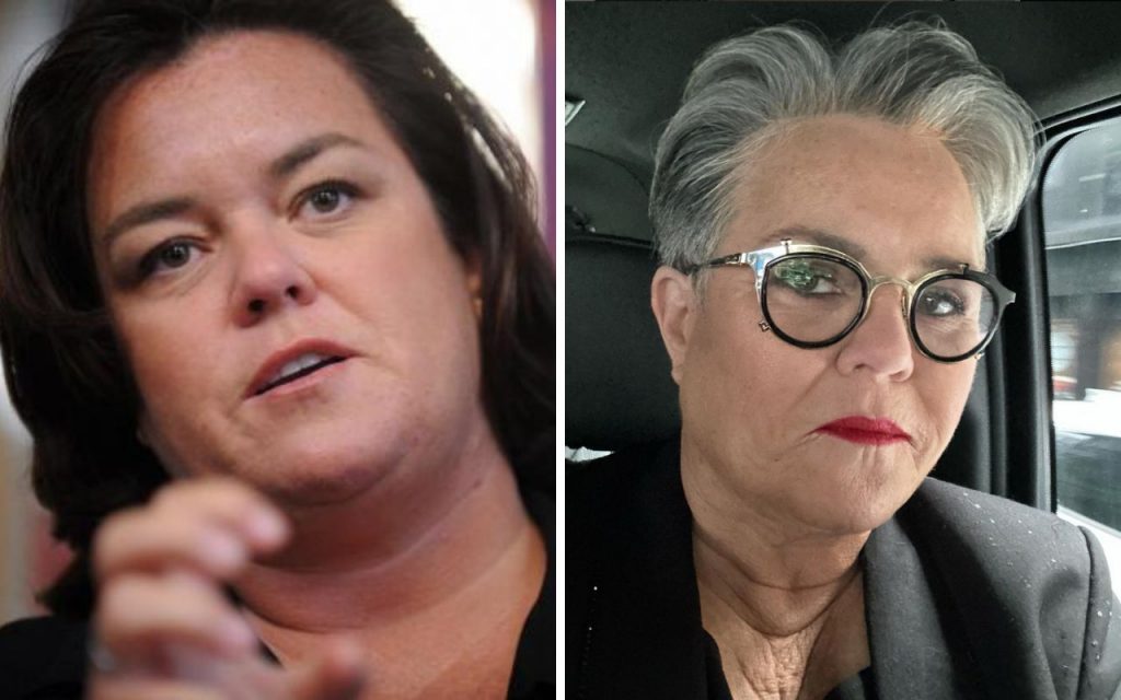 Rosie O'Donnell antes e depois da cirurgia bariátrica