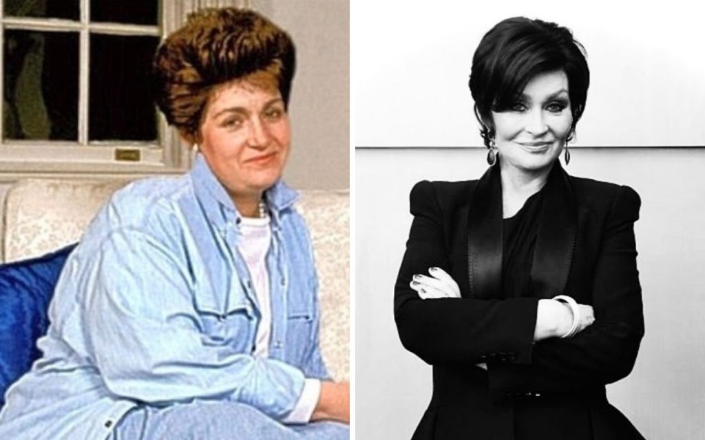Sharon Osbourne antes e depois da cirurgia bariátrica
