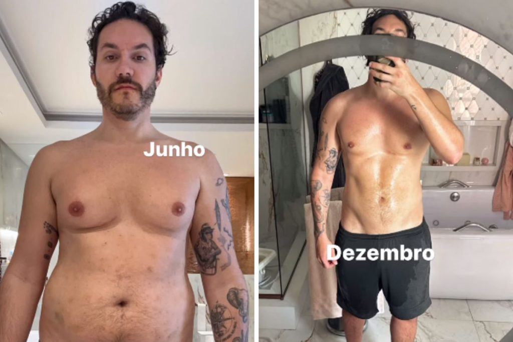 Eliezer mostra antes e depois de cirurgia nas mamas e lipoaspiração