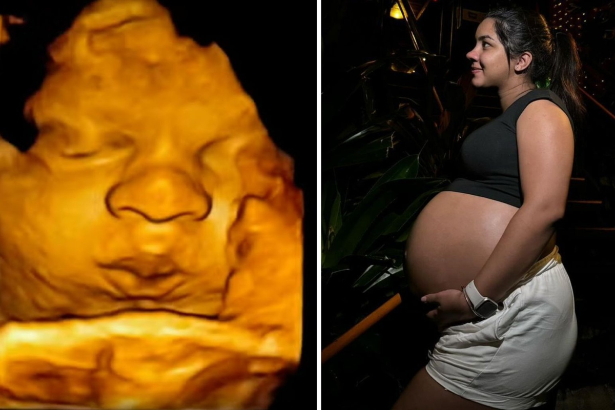 Ary Mirelle exibindo a barriga e imagem da ultrassonografia do bebê que ela espera